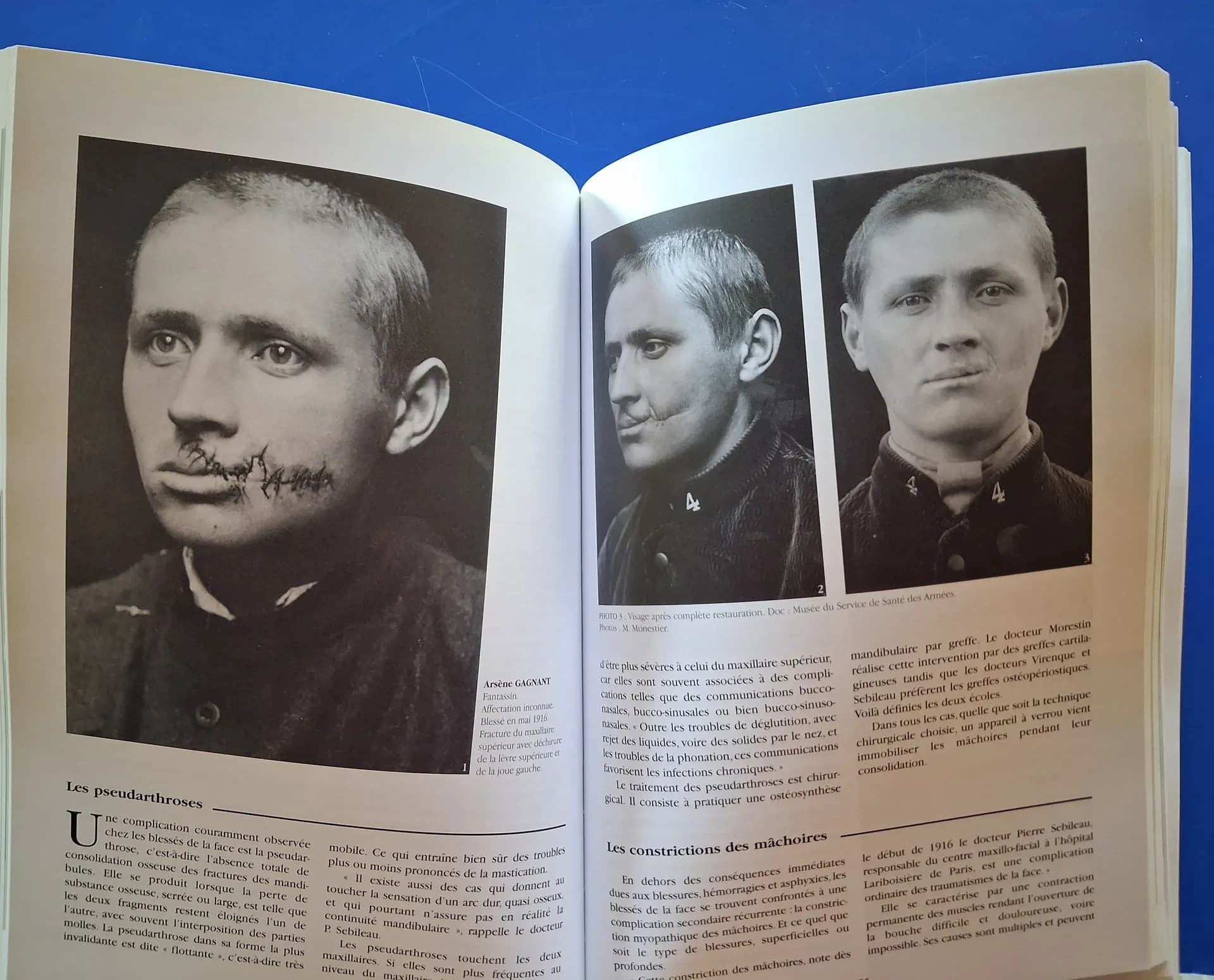 Livre "les gueules cassés" Martin Monestier - 5