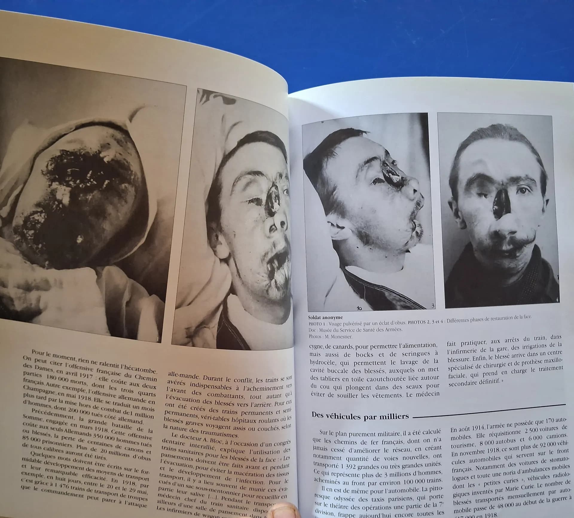 Livre "les gueules cassés" Martin Monestier - 6